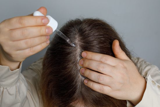 minoxidil, caida, cabello, pelo, saber