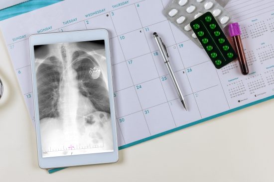 tuberculsosis enfermedad
