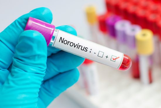 Norovirus en crucero de California